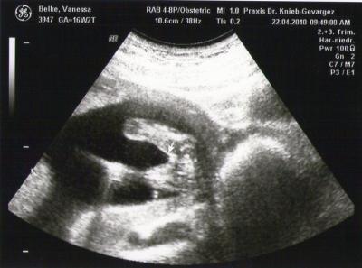 Bild zu @dawn (outing) - Forum für November - Mamis