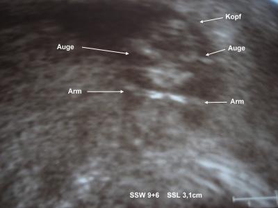 Bild zu War heute beim FA - Forum für November - Mamis