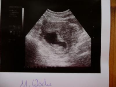 Bild zu projekt erika - Forum für November - Mamis