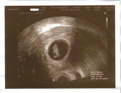 Bild zu Backup: Mein Termin vom Donnerstag - Forum für November - Mamis