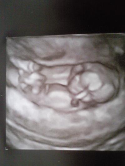 Bild zu Mich mal zurückmelden möchte - Forum für November - Mamis