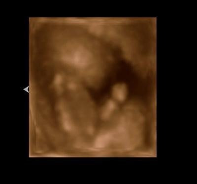 Bild zu Gestern VU und heute bissl Sorgen - Forum für November - Mamis