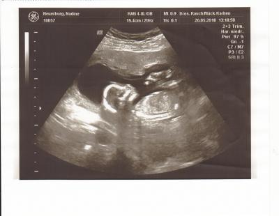 Bild zu Gestern VU & Outing - Forum für November - Mamis