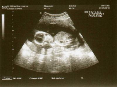 Bild zu Und hier das neue Bild - Forum für November - Mamis