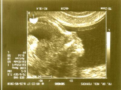 Bild zu VS letzte Woche / Zwerg2010 zeigt sein Gesicht / Kind spüren - Forum für November - Mamis