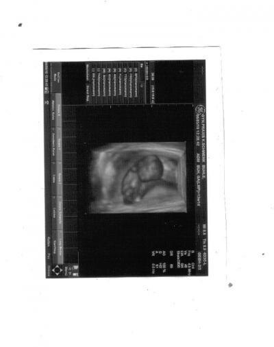 Bild zu das laaaaaangersehnte 3D-Bild - Forum für November - Mamis