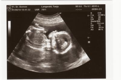 Bild zu Hier auch mal ein Bild von meinem Krümel.... - Forum für November - Mamis