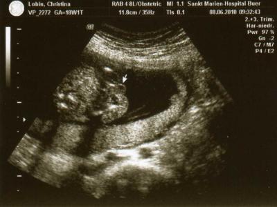 Bild zu Zurück aus dem Krankenhaus - Forum für November - Mamis