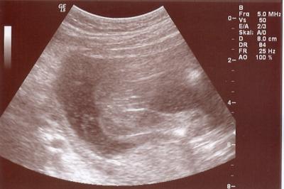 Bild zu nochmal wegen Outing-Bild - kleine Umfrage :-) - Forum für November - Mamis