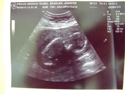 Bild zu Zurück vom FA - Forum für November - Mamis