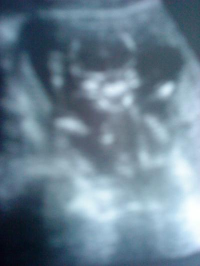 Bild zu hallo ich bin .... - Forum für November - Mamis