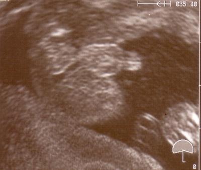 Bild zu Was bin ich... - Forum für November - Mamis