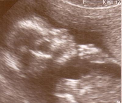 Bild zu Danke... - Forum für November - Mamis