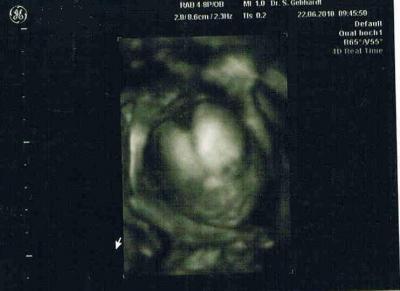 Bild zu hallo us bild - Forum für November - Mamis