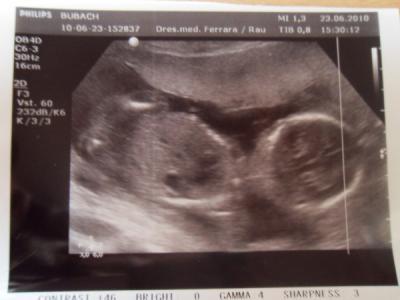 Bild zu War außerplanmäßig beim FA. 80%iges Outing :D - Forum für November - Mamis