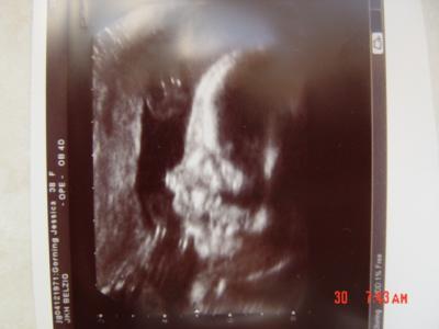 Bild zu Zurück von der FD....... - Forum für November - Mamis