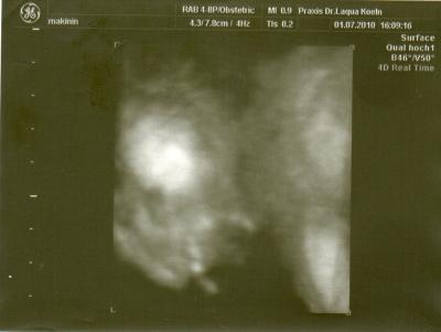 Bild zu Heute 2. screening + US bild :) - Forum für November - Mamis