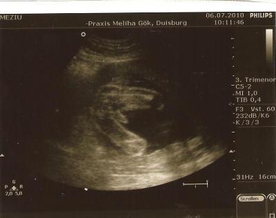 Bild zu @dawn: outing - Forum für November - Mamis