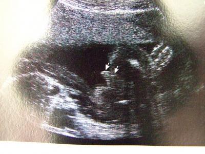 Bild zu Zurück von Fd - Forum für November - Mamis