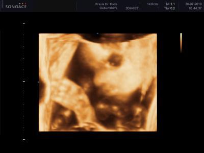 Bild zu Habe endlich meine 3D Bilder bekommen... - Forum für November - Mamis