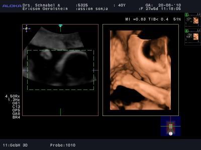 Bild zu Unser Projekt "Erika" - Forum für November - Mamis