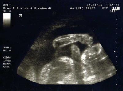 Bild zu Sooo.... - Forum für November - Mamis