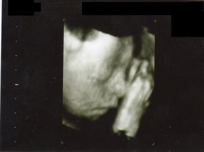 Bild zu Sorry aber muss mich mal ausheulen - Forum für November - Mamis