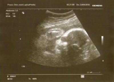 Bild zu Neues Krümel-Portrait! - Forum für November - Mamis