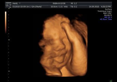 Bild zu Unser Herzchen ... Aktuelles von uns ... laaange! - Forum für November - Mamis