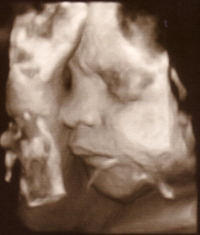 Bild zu ein kleiner Schelm... - Forum für November - Mamis