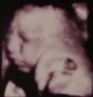 Bild zu Heute auch Vu gehabt und endlich auch mal wieder ein Bild :) - Forum für November - Mamis