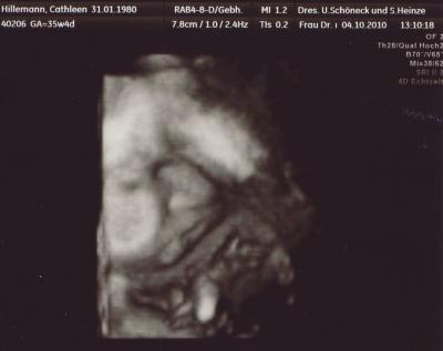 Bild zu Bilder vom Zusatz-Ultraschall - Forum für November - Mamis