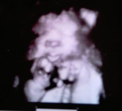 Bild zu Gestern auch VU gehabt!! aaaaangst... - Forum für November - Mamis