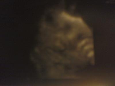 Bild zu zurück von vu + us bild :) fragen und hab ich denn jetzt alles?? - Forum für November - Mamis