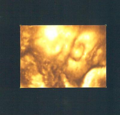 Bild zu war eben bei ctg und vu... - Forum für November - Mamis