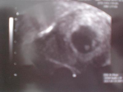 Bild zu Foto! - Forum für November - Mamis