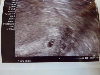 Bild zu Zurück vom FA - Forum für November - Mamis