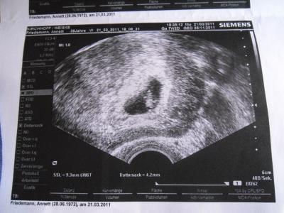 Bild zu Erste VU + Bild - Forum für November - Mamis