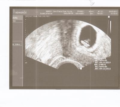 Bild zu Bild vom Krümel - Forum für November - Mamis