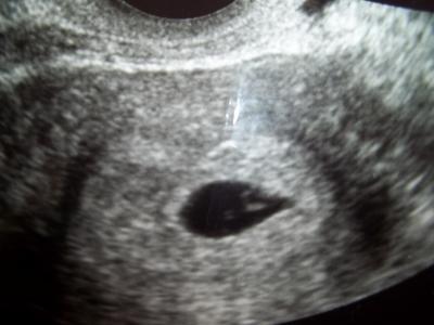 Bild zu Meine Bilder... - Forum für November - Mamis