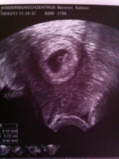 Bild zu War am Montag schon beim FA... - Forum für November - Mamis