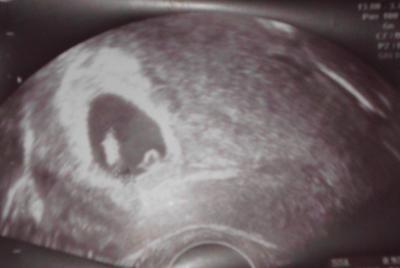 Bild zu Guckt mal :-) - Forum für November - Mamis