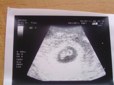 Bild zu gestern bei FA... - Forum für November - Mamis