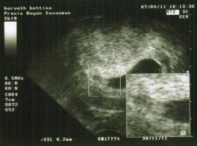 Bild zu Wie versprochen das Foto! - Forum für November - Mamis