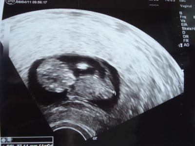 Bild zu bin wieder da!!!! - Forum für November - Mamis