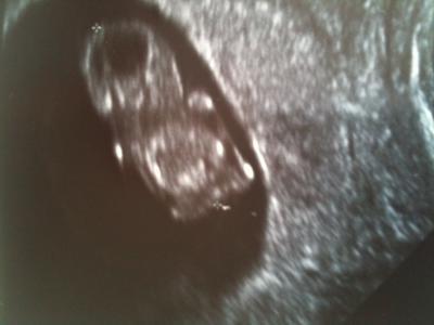 Bild zu Wie versprochen - das Foto! - Forum für November - Mamis