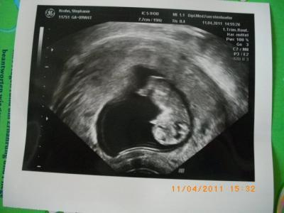 Bild zu glücklich baby gehts gut - Forum für November - Mamis