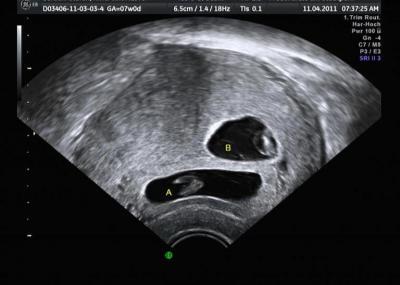 Bild zu So, jetzt auch ein Bild von mir - Forum für November - Mamis