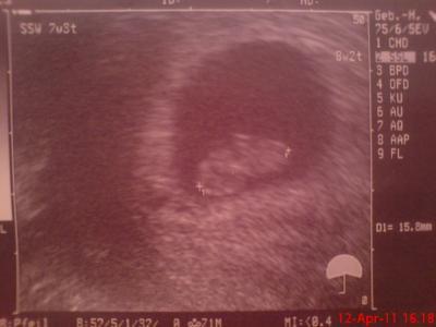 Bild zu Und nun das Foto vom Untermieter :) - Forum für November - Mamis