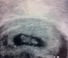 Bild zu Hab ja noch gar kein... - Forum für November - Mamis